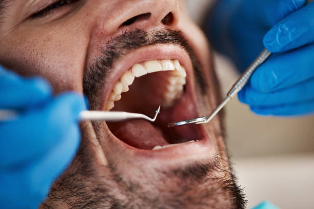 Best Cracked Tooth Emergency Dentist  in North Aurora, IL